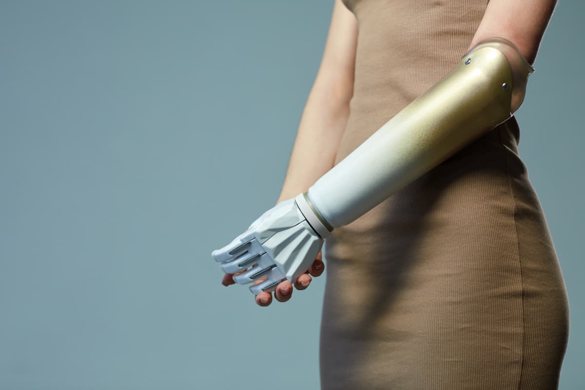 Synthetic Skin and Robotic Limbs: The Real-World Prosthetics Revolution