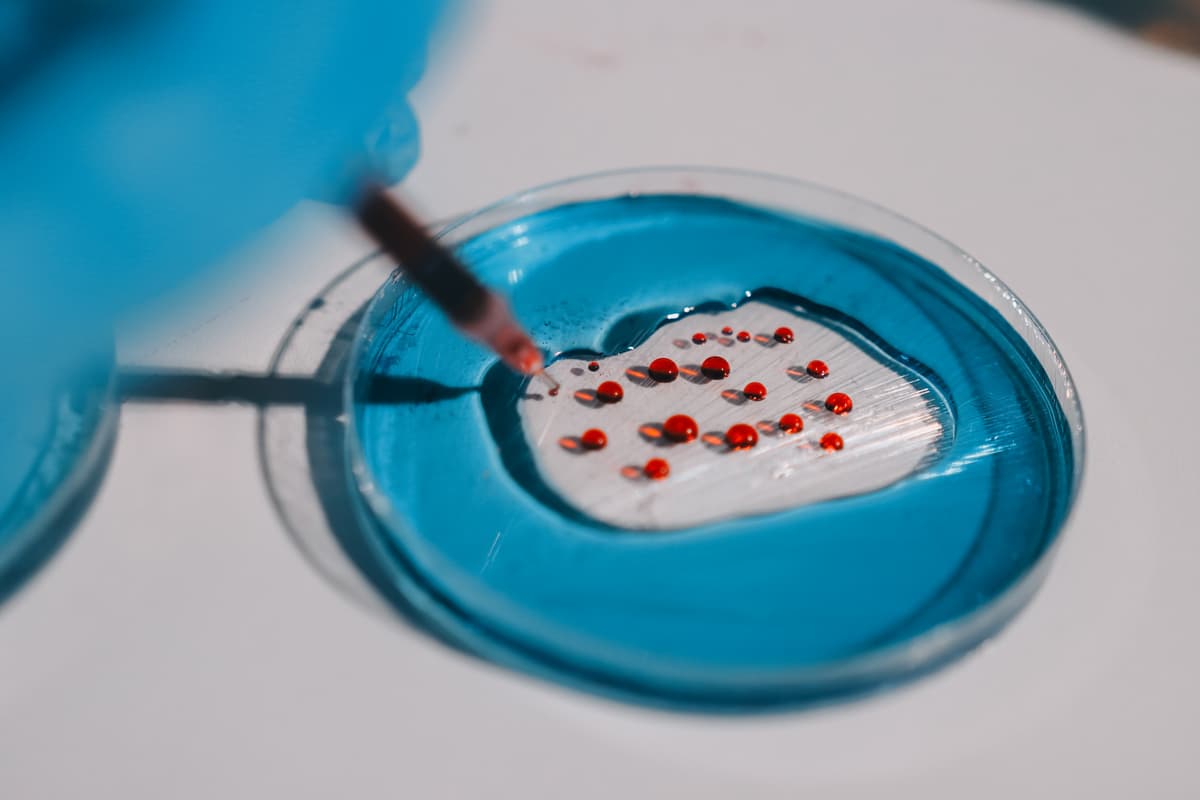 Featured image for: The Promise of Liquid Biopsies for Early, Multi-Cancer Detection